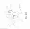 Fig. 45 - Method and apparatus for spondylolysis repair