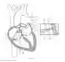 Fig. 07 - Electrosurgical device having a distal aperture