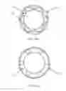 Fig. 23 - Radio frequency ablation method, system and radio frequency ablation device thereof