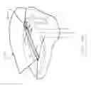 Fig. 30 - Surgical drape with separable elements