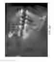 Fig. 46 - Unified three dimensional virtual craniofacial and dentition model and uses thereof