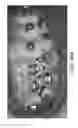 Fig. 47 - Unified three dimensional virtual craniofacial and dentition model and uses thereof