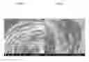 Fig. 09 - Method and device for treating caries using locally delivered microwave energy