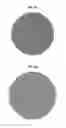 Fig. 04 - Process for preparing hernia mesh from monofilament