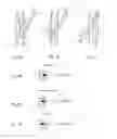 Fig. 02 - Vascular filter and anchoring arrangement thereof
