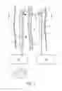 Fig. 02 - Methods and systems for providing or maintaining fluid flow through body passages