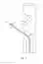 Fig. 04 - Methods and systems for providing or maintaining fluid flow through body passages
