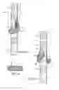 Fig. 03 - Branched vessel endoluminal device