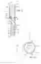 Fig. 07 - Branched vessel endoluminal device