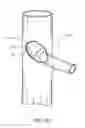 Fig. 23 - Branched vessel endoluminal device