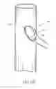 Fig. 24 - Branched vessel endoluminal device