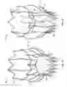 Fig. 02 - Collapsible/expandable prosthetic heart valves with native calcified leaflet retention features