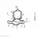 Fig. 17 - Intracardiac cage and method of delivering same