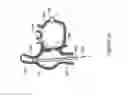 Fig. 19 - Intracardiac cage and method of delivering same
