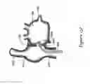 Fig. 25 - Intracardiac cage and method of delivering same