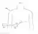 Fig. 03 - Penile implant
