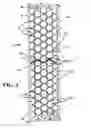 Fig. 02 - Mosaic implants, kits and methods for correcting bone defects