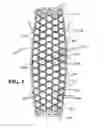Fig. 04 - Mosaic implants, kits and methods for correcting bone defects