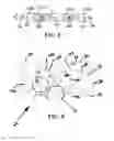 Fig. 06 - Mosaic implants, kits and methods for correcting bone defects