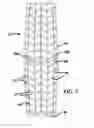 Fig. 08 - Mosaic implants, kits and methods for correcting bone defects