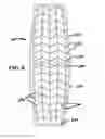 Fig. 09 - Mosaic implants, kits and methods for correcting bone defects