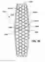 Fig. 22 - Mosaic implants, kits and methods for correcting bone defects
