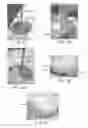 Fig. 32 - Augmented glenoid components and devices for implanting the same