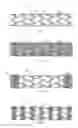 Fig. 02 - Compositions, devices, kits and methods for attaching stent-containing medical devices to tissue