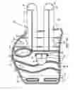 Fig. 02 - Wrist brace
