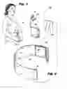 Fig. 02 - UTERINE COMPRESSION DEVICES AND METHODS