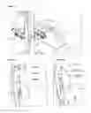 Fig. 06 - Backrest angle adjustment system on a seat for a physically disabled person