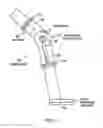 Fig. 02 - Orthotic device drive system and method