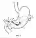 Fig. 07 - BARIATRIC DEVICE AND METHOD