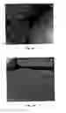 Fig. 02 - NANOPARTICLES FOR DERMAL AND SYSTEMIC DELIVERY OF DRUGS