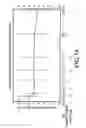 Fig. 10 - Devices and methods for sustained treatment of bladder pain and irritative voiding