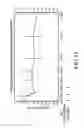 Fig. 13 - Devices and methods for sustained treatment of bladder pain and irritative voiding