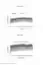 Fig. 06 - Implantable, Malleable Calcium Phosphate Compositions and Methods for Making and Using the Same
