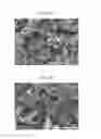 Fig. 08 - Implantable, Malleable Calcium Phosphate Compositions and Methods for Making and Using the Same
