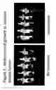 Fig. 02 - Tumor vaccines and methods of use thereof