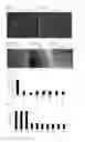 Fig. 02 - Composition for gene delivery comprising chitosan and liquid crystal formation material
