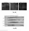 Fig. 08 - BRAIN TUMOR TARGETING PEPTIDES AND METHODS