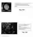 Fig. 14 - BRAIN TUMOR TARGETING PEPTIDES AND METHODS