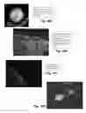 Fig. 18 - BRAIN TUMOR TARGETING PEPTIDES AND METHODS