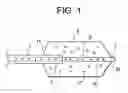 Fig. 02 - Vertebral body augmentation systems comprising microbubbles