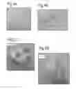 Fig. 06 - Solid substrates for mitigating or preventing cell and tissue adhesion and vascularization