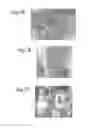 Fig. 08 - Solid substrates for mitigating or preventing cell and tissue adhesion and vascularization