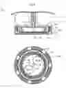 Fig. 08 - Operable implant