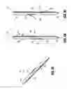 Fig. 08 - Symmetrical tip acute catheter
