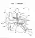 Fig. 02 - Vent cap for a Eustachian tube dilation system