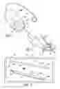 Fig. 02 - Magnet installation systems and methods for use with cochlear implants